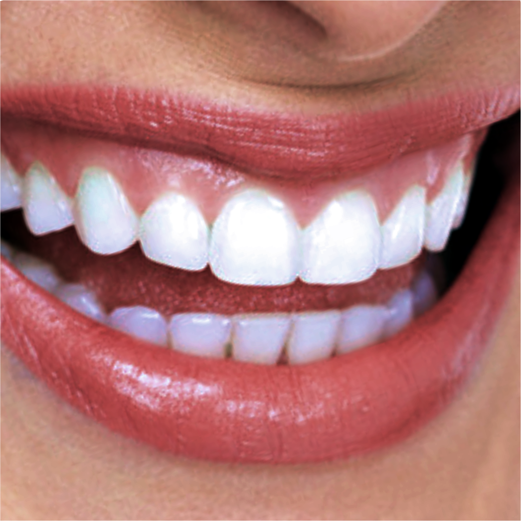 Mouth showing White Teeth